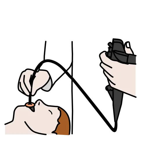 Gastroscopia, exploración del estómago