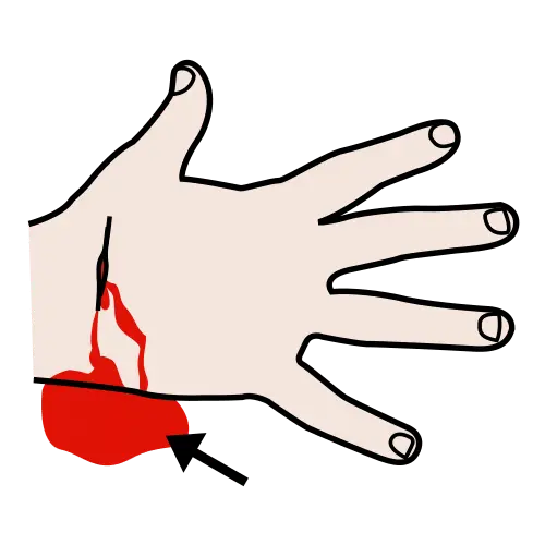 Sangre